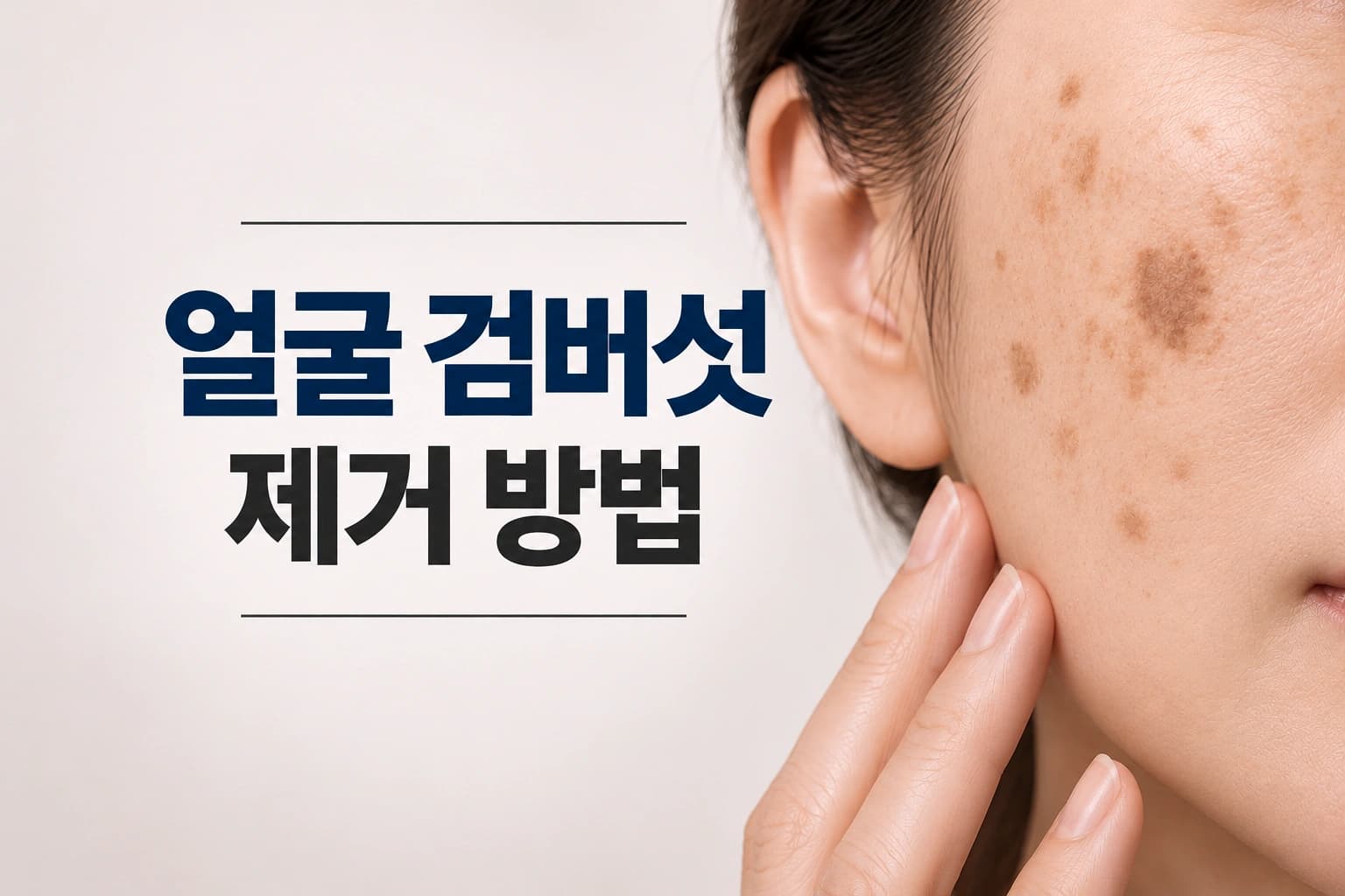 얼굴에 갈색 검버섯과 색소 병변이 나타난 여성의 피부를 담은 검버섯 제거 방법 안내 썸네일